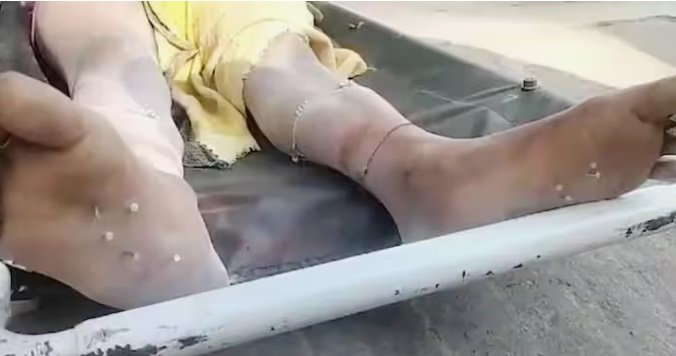 Wबर्बरता की सारी हदें पार! महिला के पैर में ठोकी 9 कीलें, लाश देखकर कांप गया लोगों का कलेजा