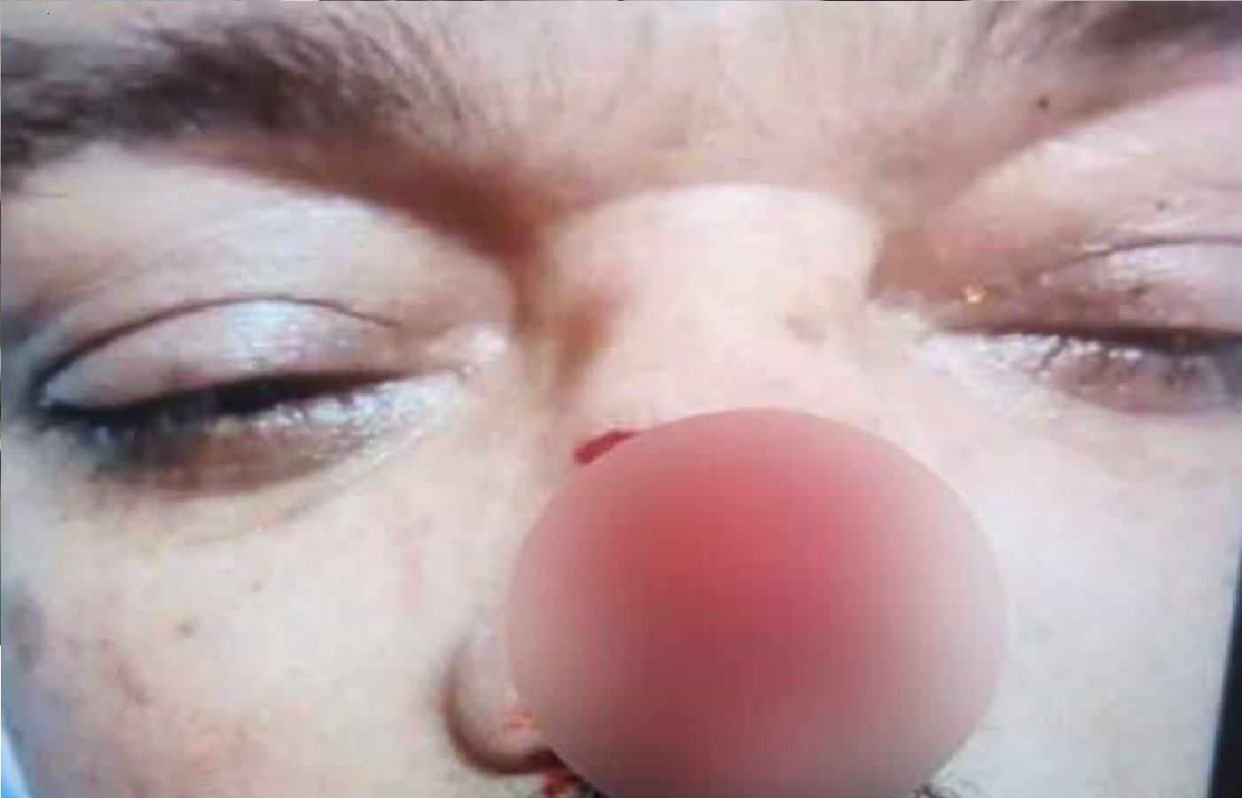 Wपार्किंग को लेकर हुए विवाद में युवक ने रिटायर्ड इंजीनियर की चबाई नाक