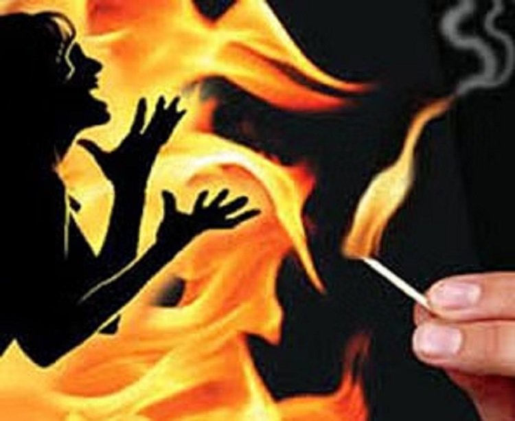नाबालिग पर बीच सड़क पेट्रोल डालकर लगा दी आग, हालत गंभीर