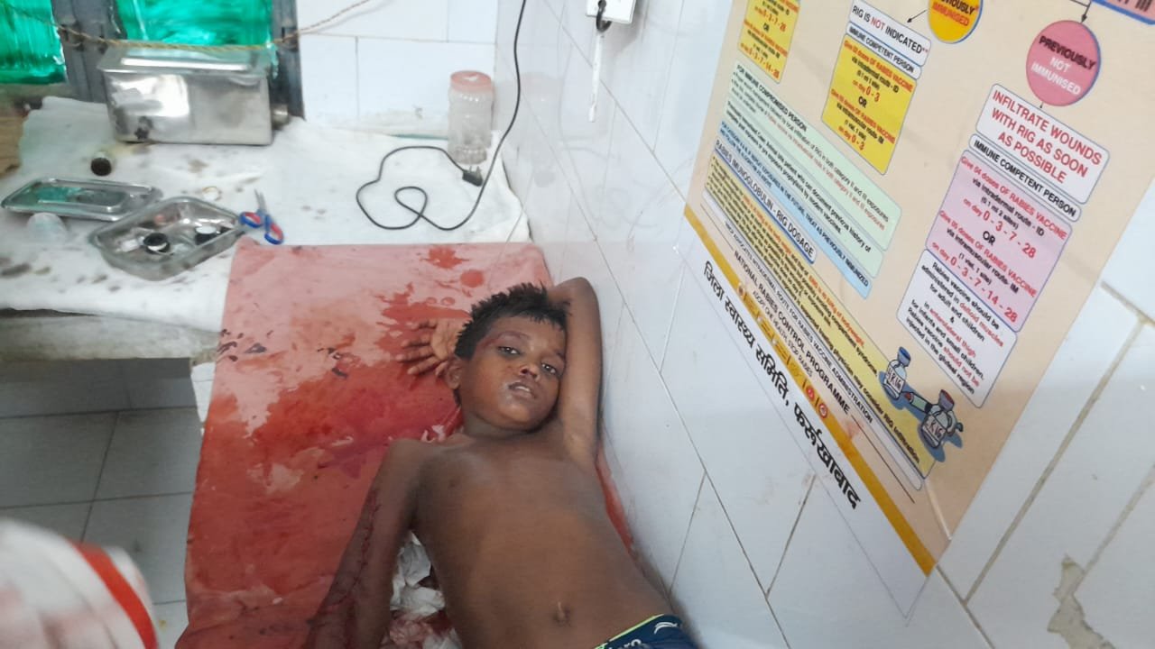 Wकांवरियों से भरे ट्रैक्टर ने बालक को कुचला हालत गंभीर